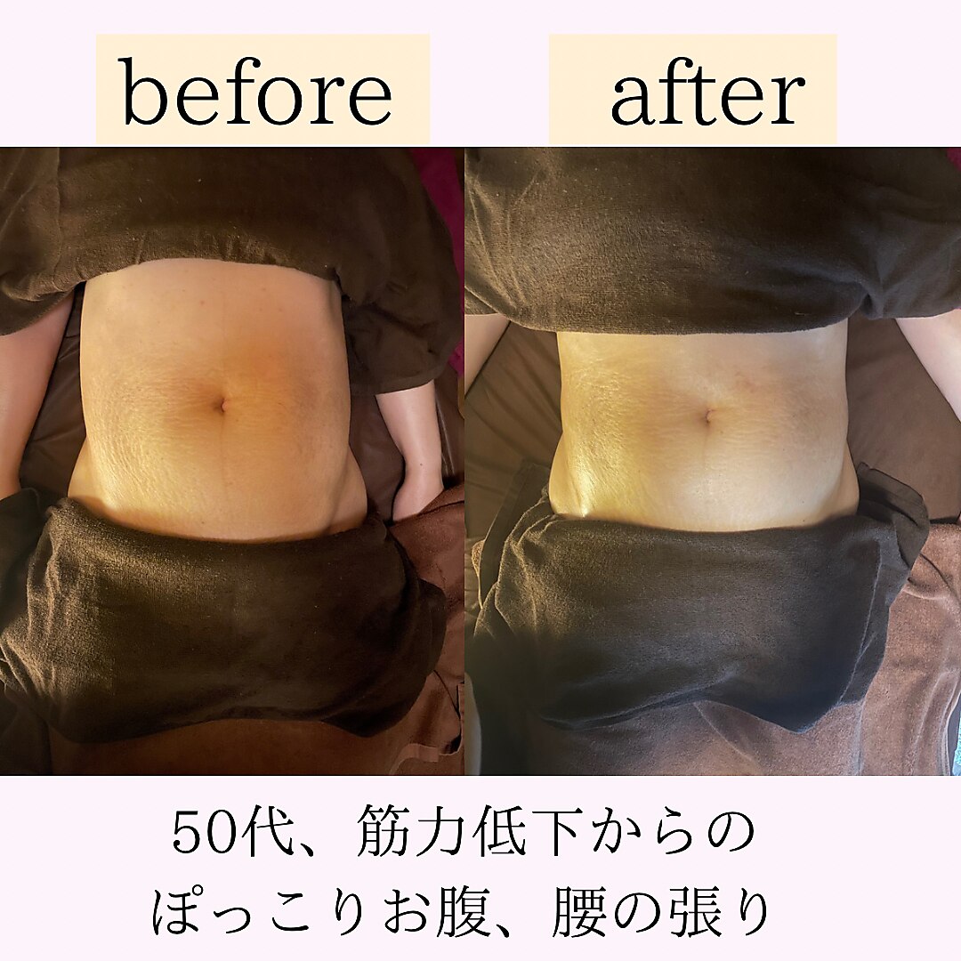 施術後のドリンクサービス