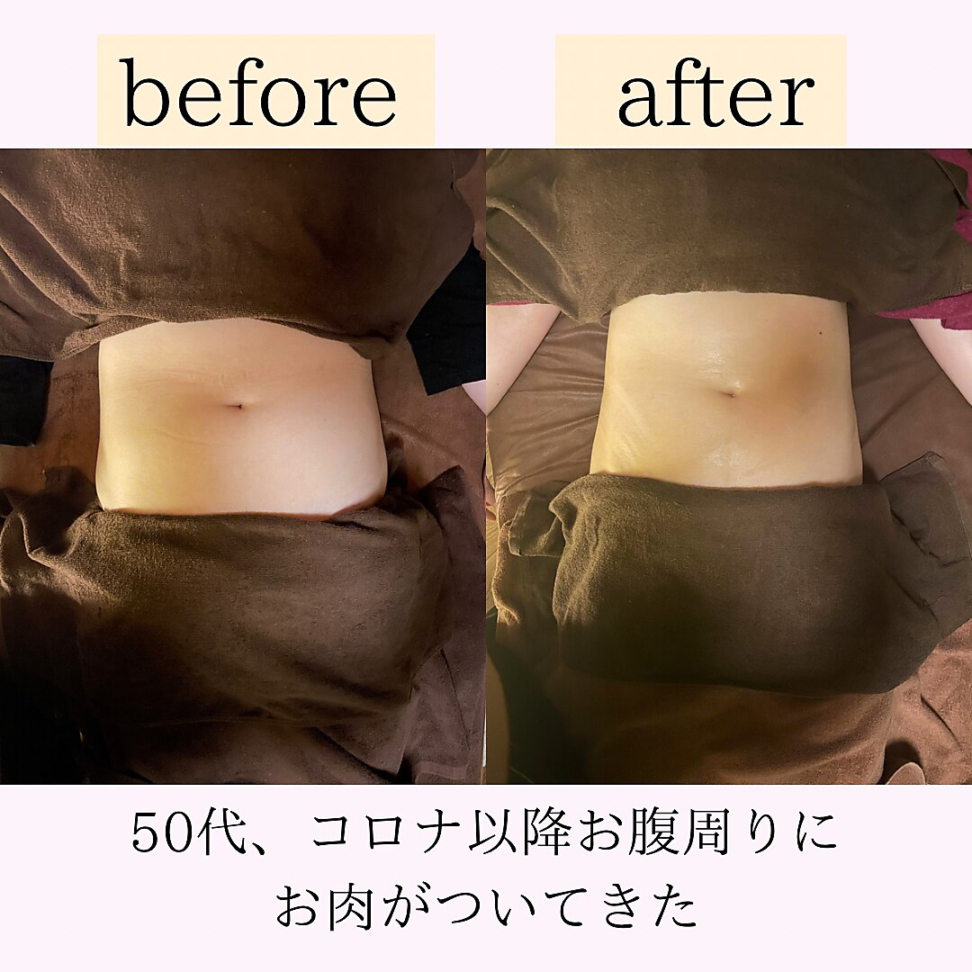 腸もみ施術の様子